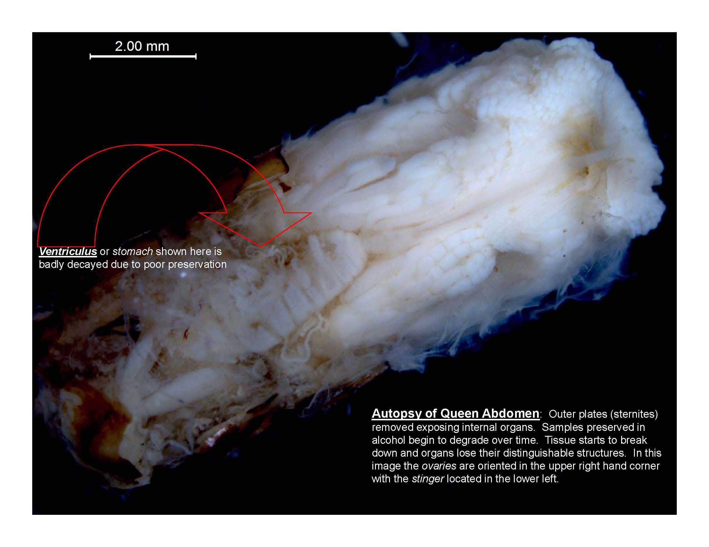 Abdomen Dissection