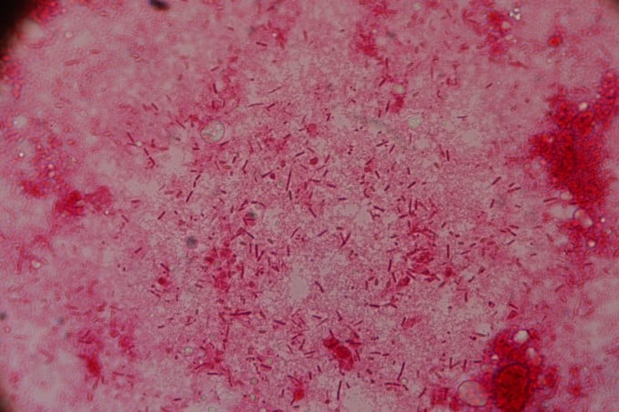 An unidentified bacteria from a honey bee colony 