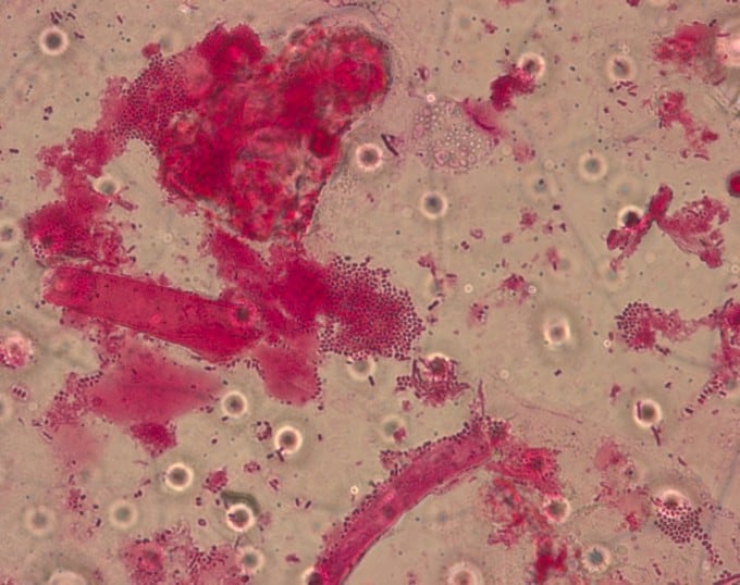 Melissococcus plutonius from comb  Photo Credit:  I. B. Smith, Jr.,USDA