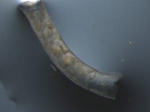 A cloudy trachea with light scarring, the white/yellow figures are tracheal mites.  Viewed at 40x (approx.) using a dissecting microscope