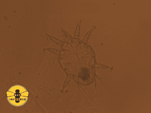 Tracheal mite, Acarapis woodi, seen with a compound microscope at 40x magnification