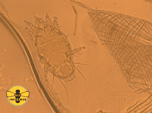 Another tracheal mite, seen with a compound microscope at 40x magnification